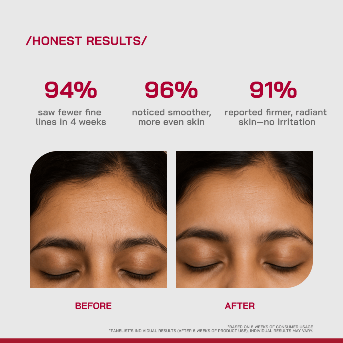 0.3% Pure Retinol Face Serum - /PHD/ - Proven Honest Derma