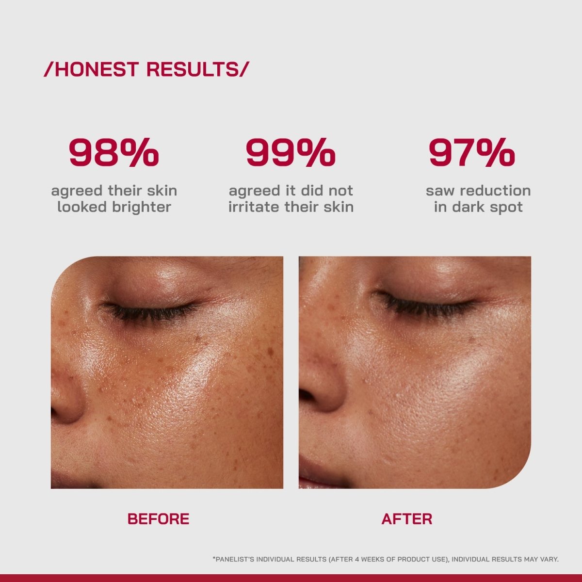 10% Vitamin C Brightening Serum - /PHD/ - Proven Honest Derma