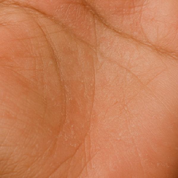 After using 1% Ceramides Intensive Repair Cream