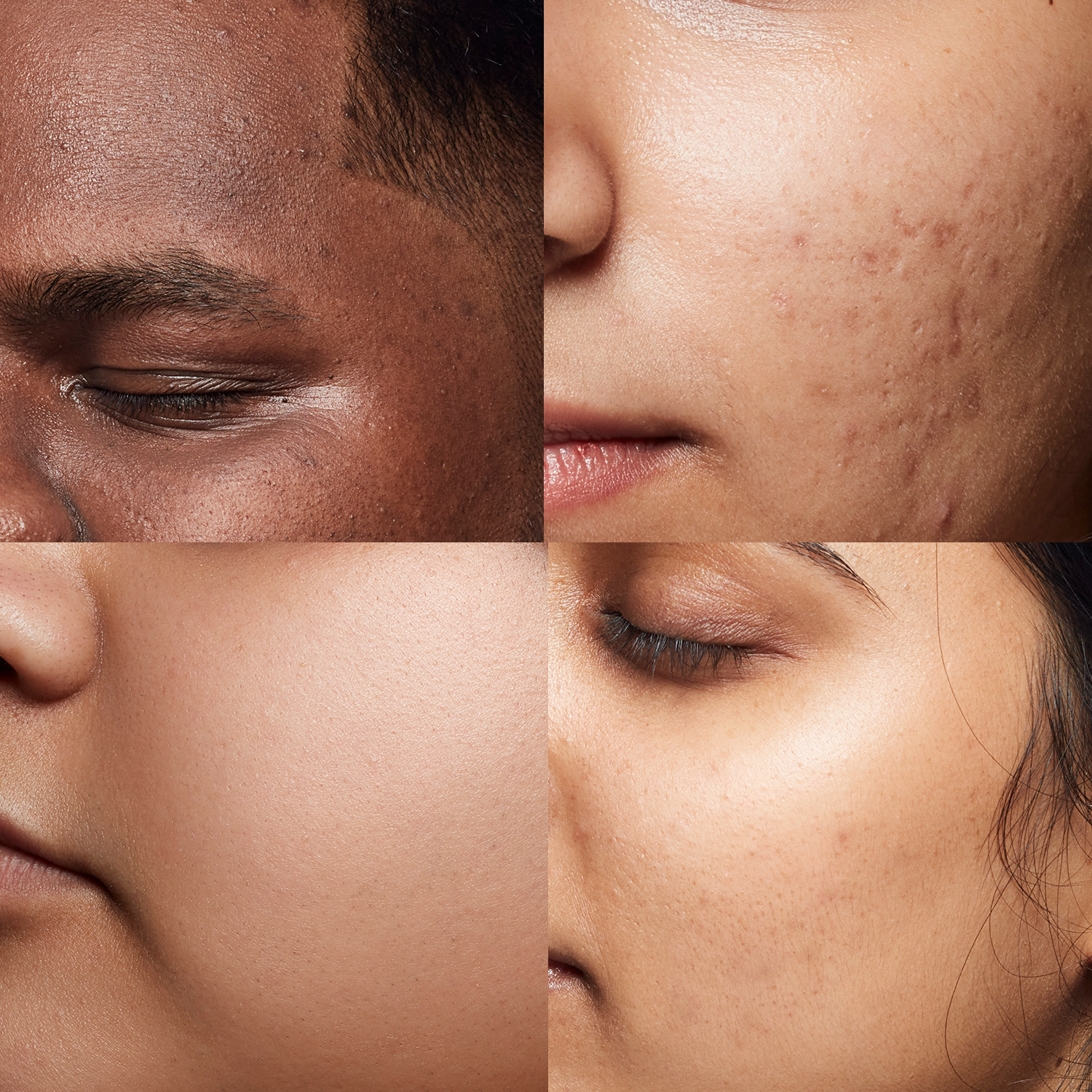 All Skin Types