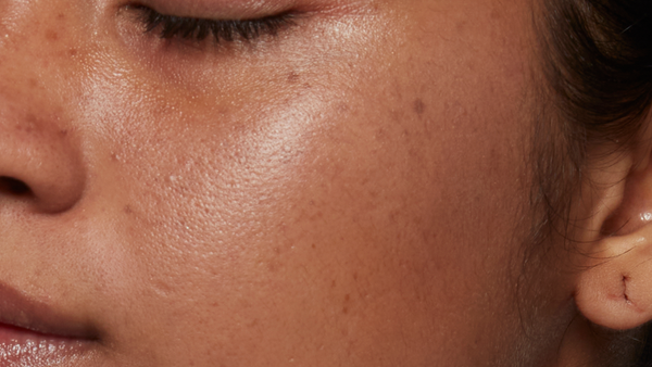 After using 10% Vitamin C Brightening Serum