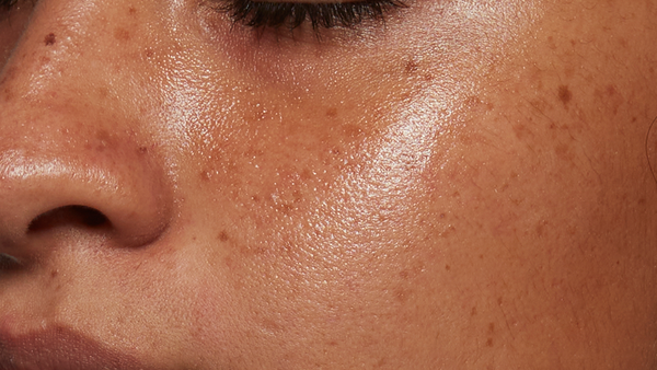 Before using 10% Vitamin C Brightening Serum