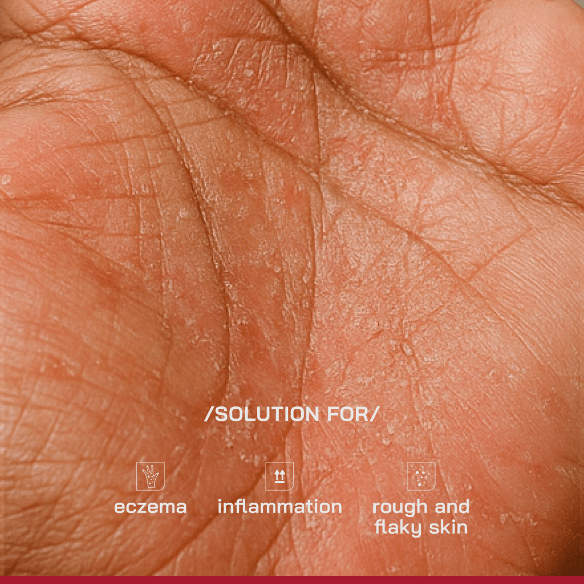 1% Ceramides Intensive Repair Cream - /PHD/ - Proven Honest Derma