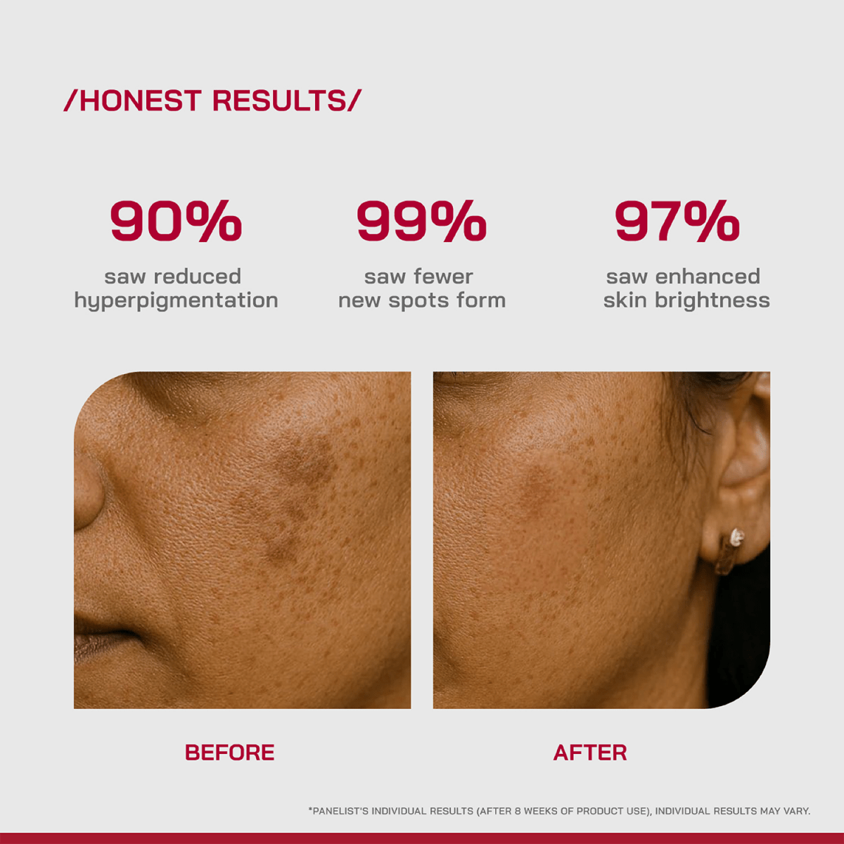 Beminimalist 2% Alpha Arbutin Depigmentation Serum 30ml - Image 11