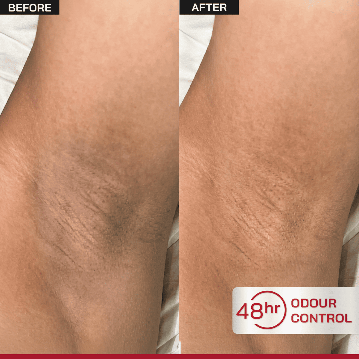6% AHA Underarm Depigmentation Roll-On - /PHD/ - Proven Honest Derma