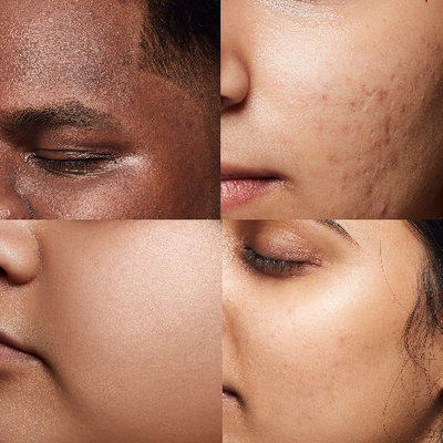 All Skin Types