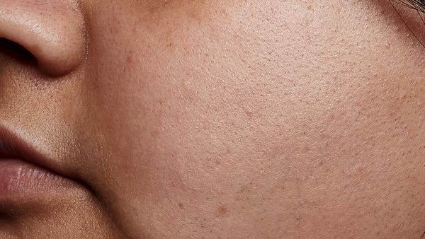 Before using 2% Hyaluronic Acid Dewy Skin Serum
