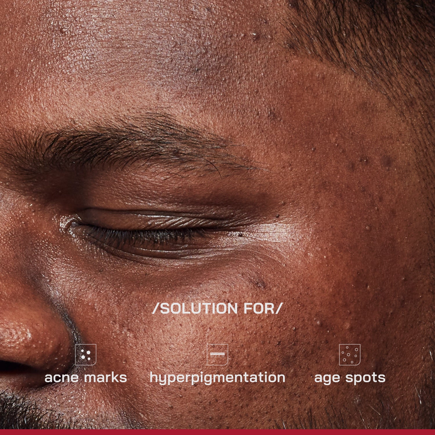 2% Alpha Arbutin Depigmentation Serum